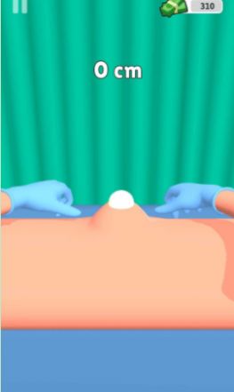 粉刺挤压游戏图3