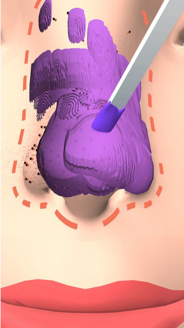 干净的鼻子最新版(2)