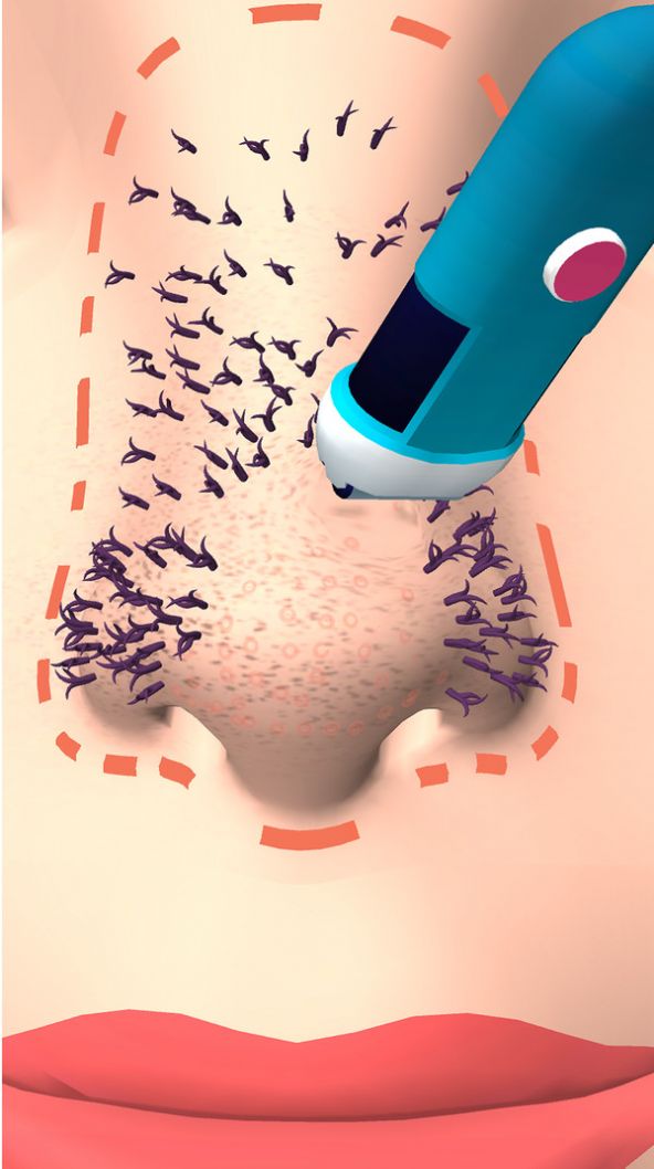 干净的鼻子最新版(1)