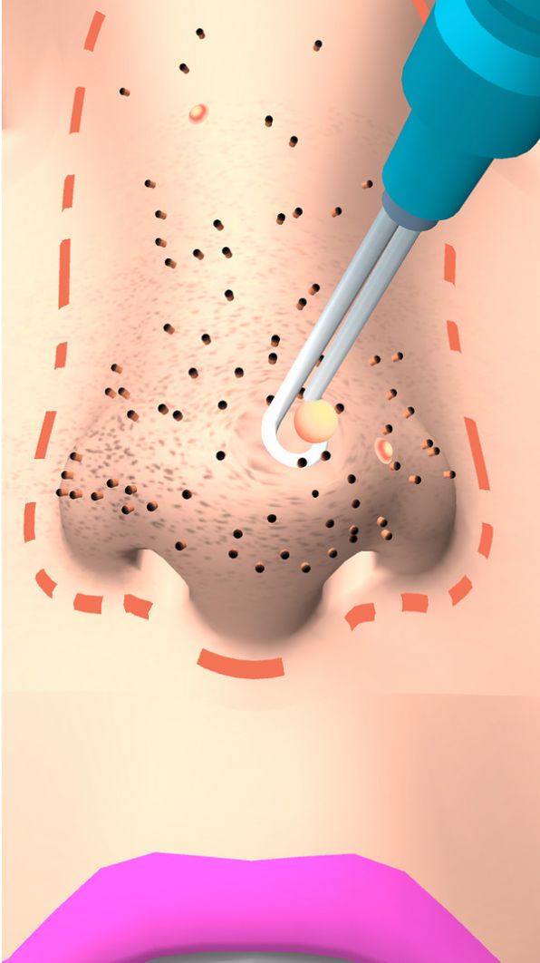 干净的鼻子最新版(3)